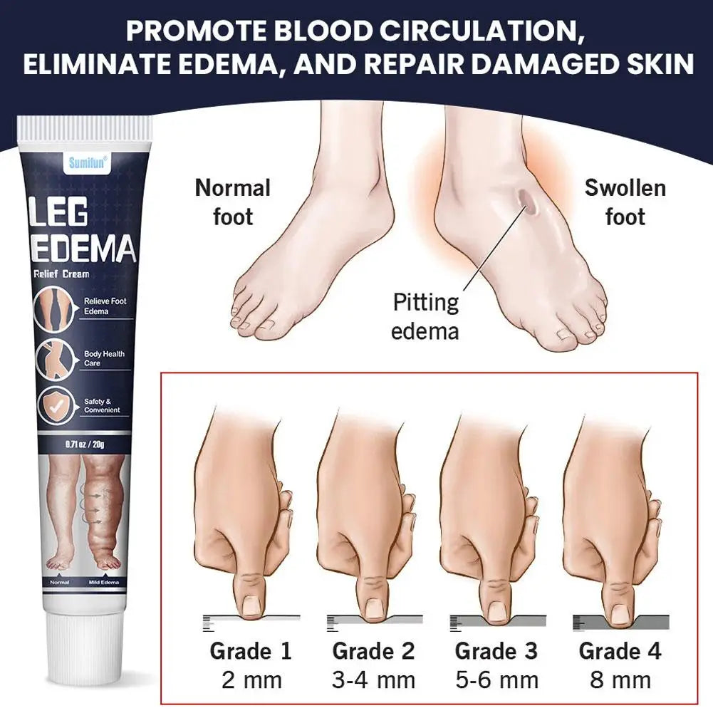 Anti Edema Foot Cream Foot Massage Health Care Cream Effective Alleviation Varicose Veins Arm Leg Swelling Pain Relaxing Cream