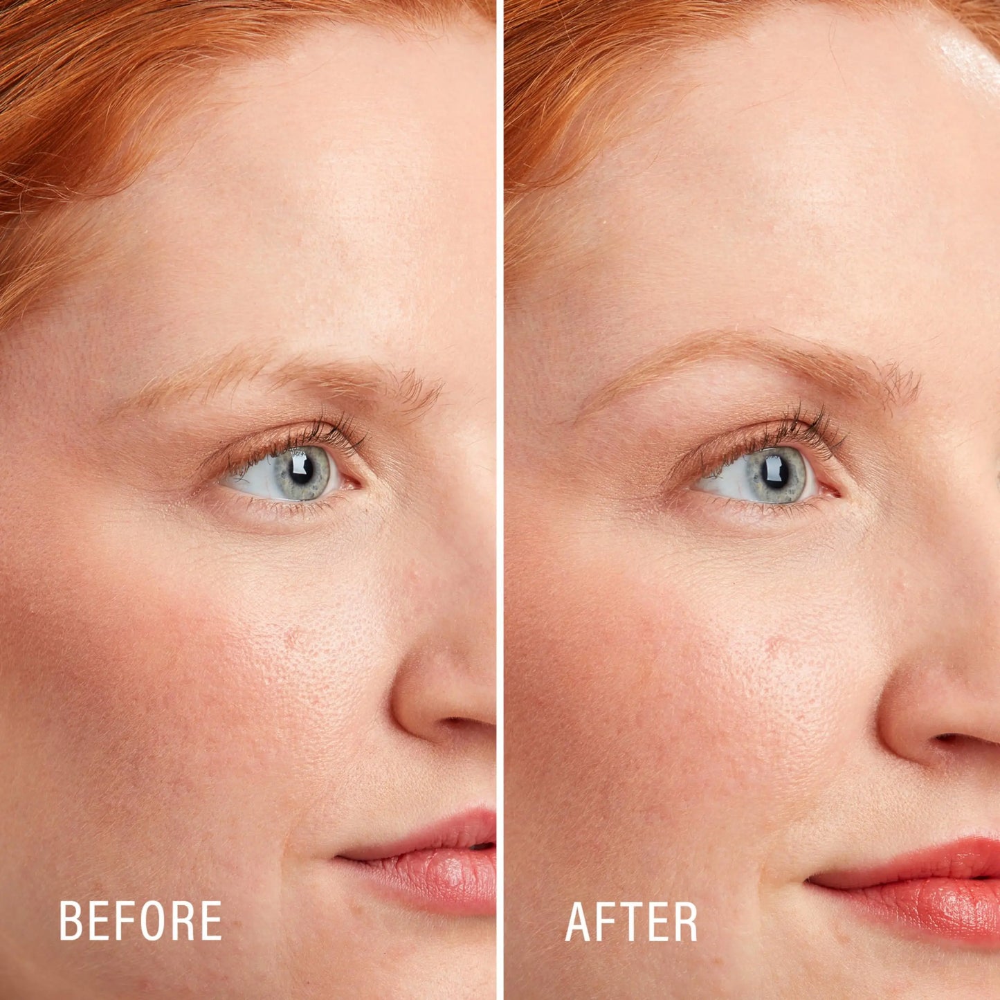 Touch Up Dermaplaning Tool With Precision Cover 3ct Dermaplane Razor Face Razors For Women Eyebrow Razor Facial Razor Dermaplani