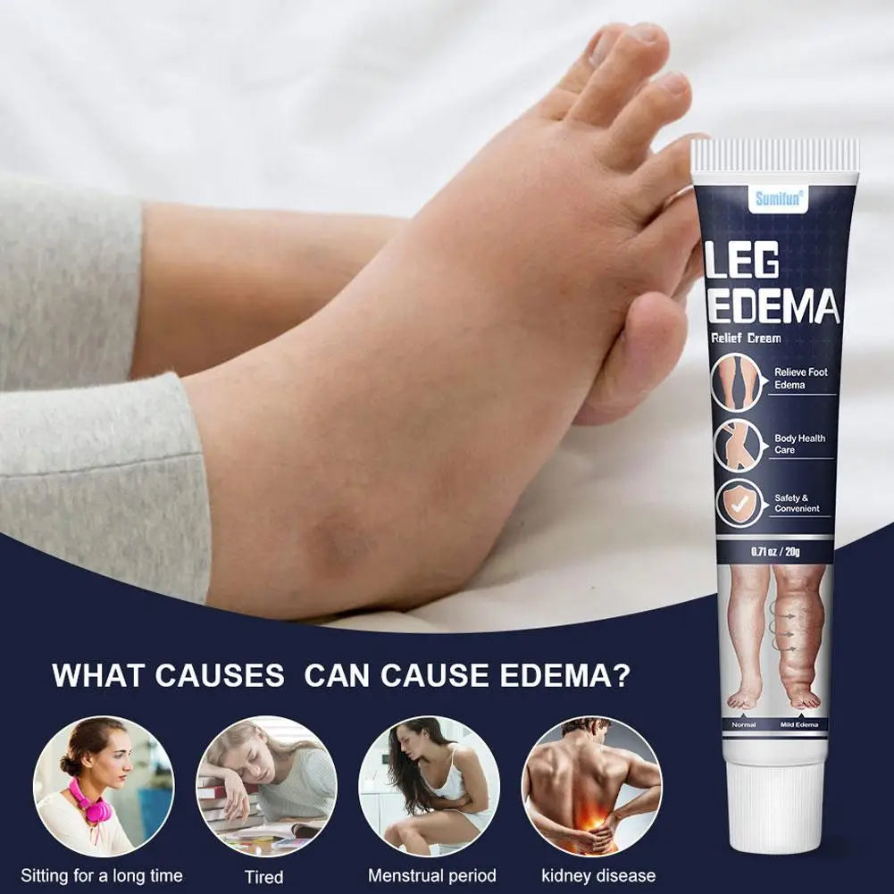 Anti Edema Foot Cream Foot Massage Health Care Cream Effective Alleviation Varicose Veins Arm Leg Swelling Pain Relaxing Cream